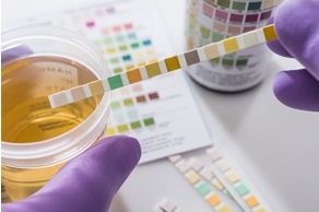 Tissue Viability Tissue Viability